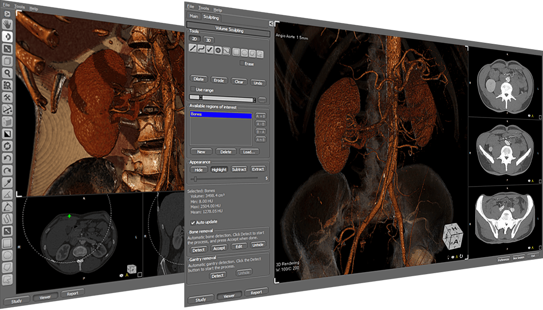 ORSVisualLite - Created by PostDICOM